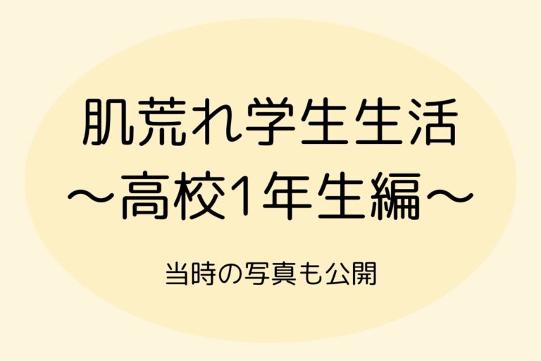 肌荒れ学生生活〜高校1年生編〜